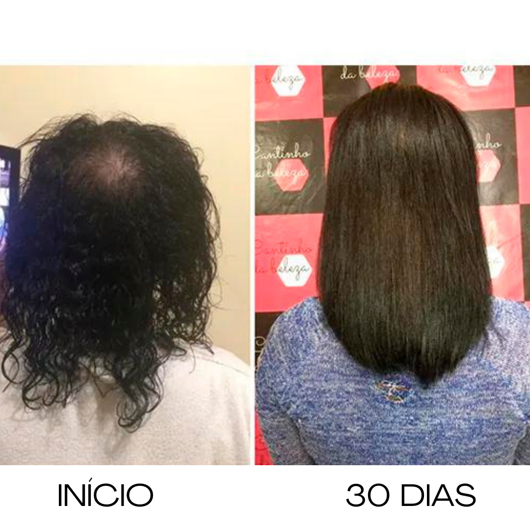 5 potes de cabelo de deusa